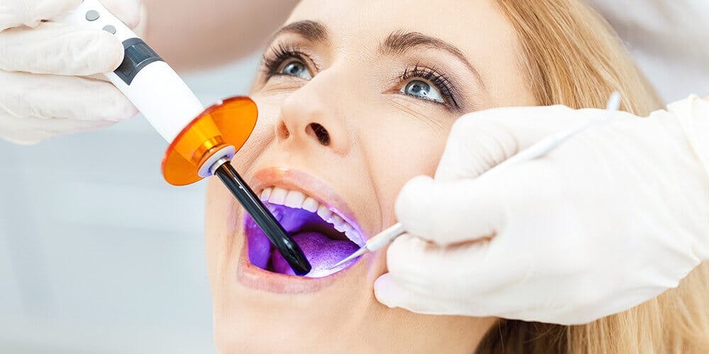 What is the purpose of dental bonding?