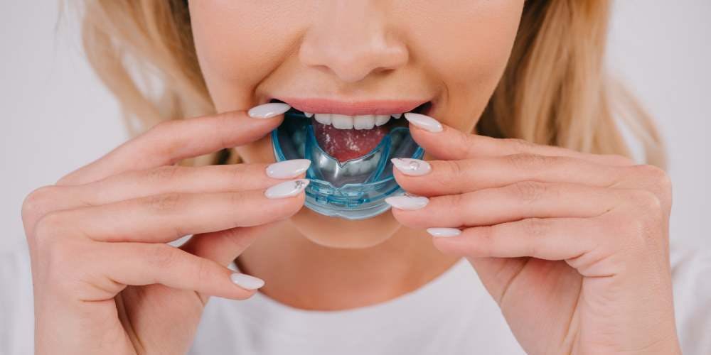 Are Mouthguards Worth the Cost? A Guide to Protection & Savings