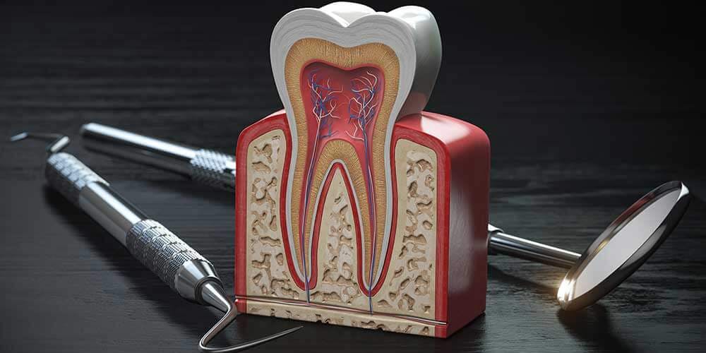 What is root canal dental treatment?