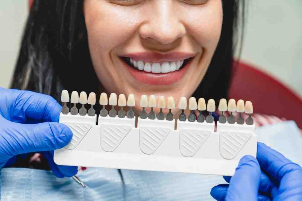 How Dental Veneers Can Transform Your Smile Everything You Need To Know